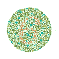 検査画像3
