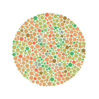 検査画像4